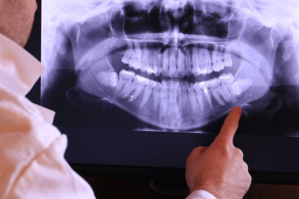 Best Emergency Root Canal Treatment in Comfort, TX