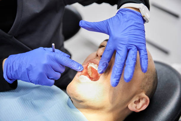 Best Emergency Root Canal Treatment in Comfort, TX